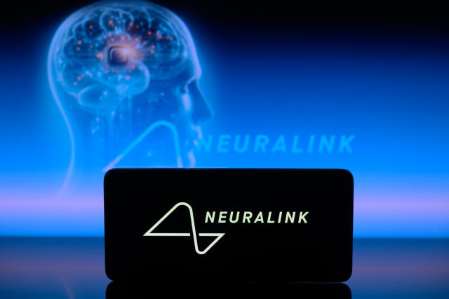 Neuralink Translation: A revolution to the Artificial intelligence [2024]